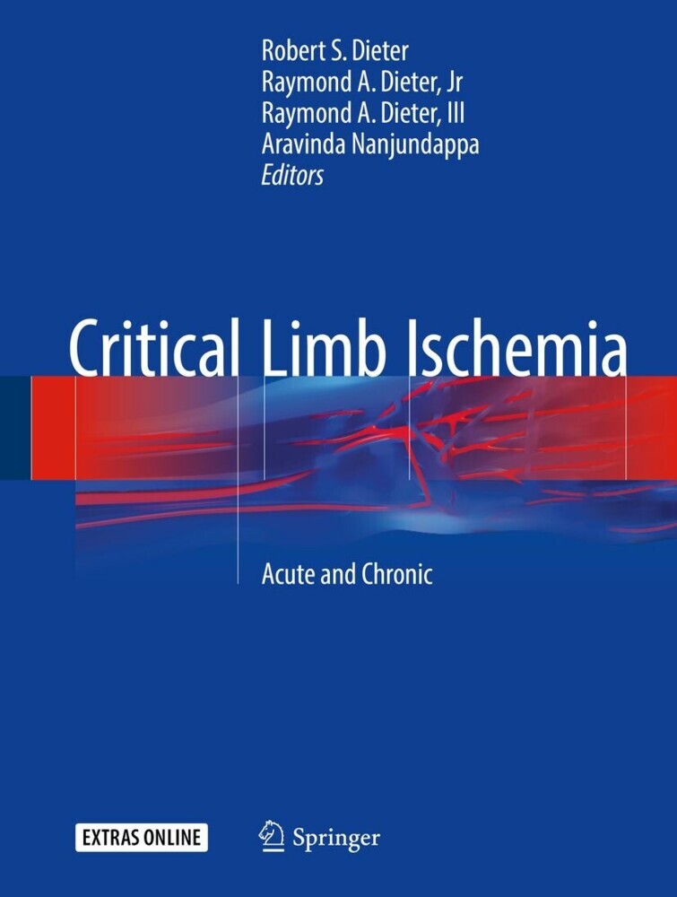 Critical Limb Ischemia main product photo