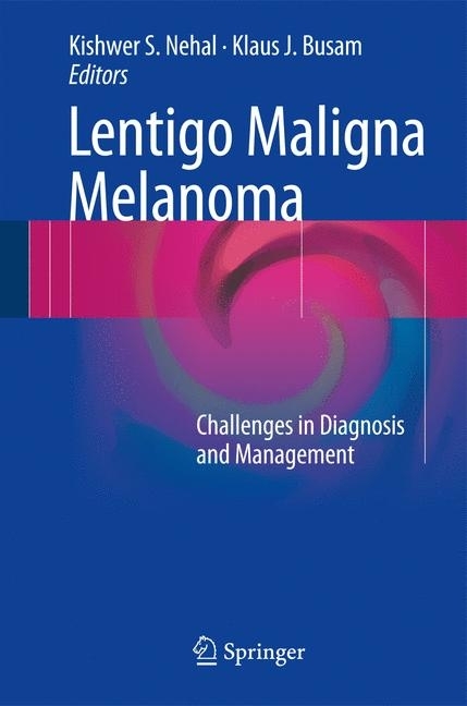 Lentigo Maligna Melanoma main product photo