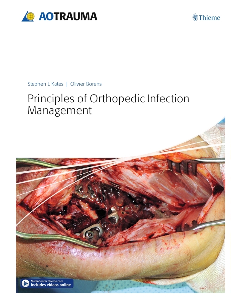 Principles of Orthopedic Infection Management main product photo