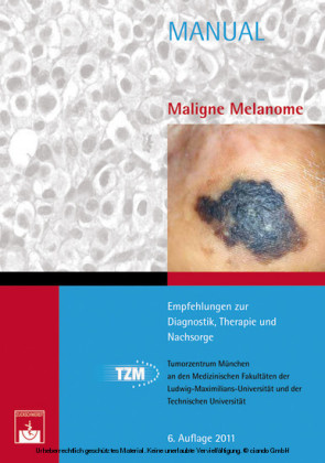 Manual Maligne Melanome