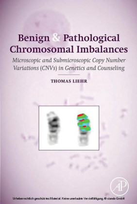 Benign and Pathological Chromosomal Imbalances