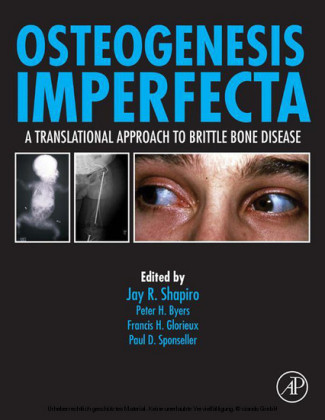 Osteogenesis Imperfecta