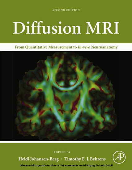 Diffusion MRI main product photo