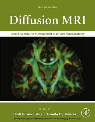 Diffusion MRI