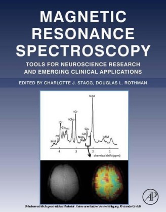 Magnetic Resonance Spectroscopy