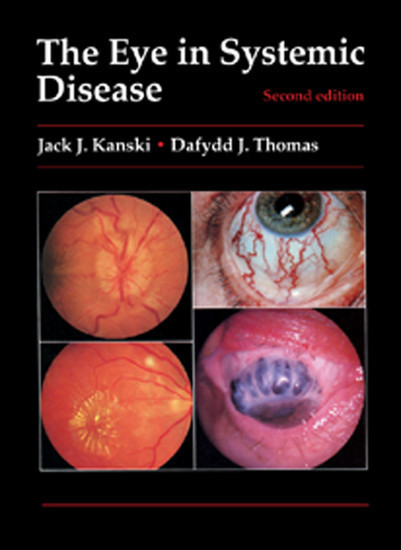 The Eye in Systemic Disease main product photo