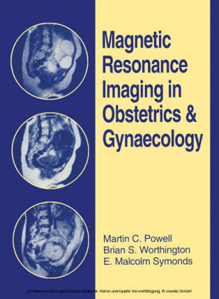 Magnetic Resonance Imaging in Obstetrics and Gynaecology