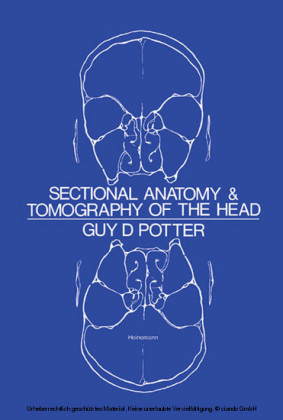 Sectional Anatomy and Tomography of the Head