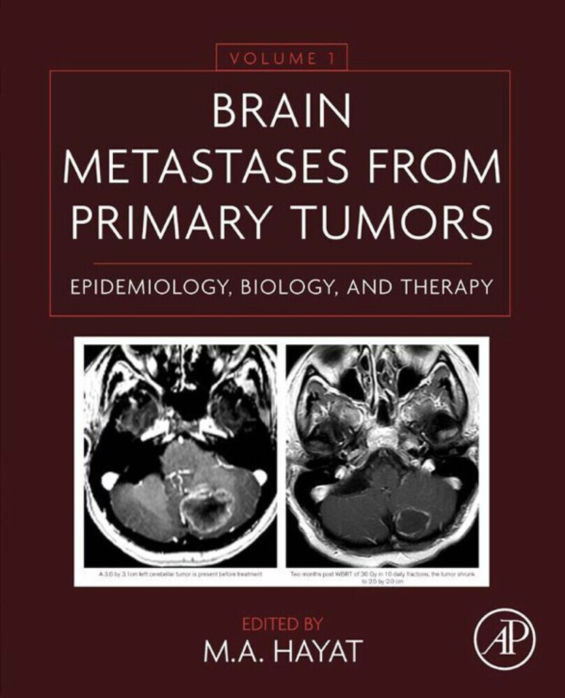 Brain Metastases from Primary Tumors Volume 1 main product photo