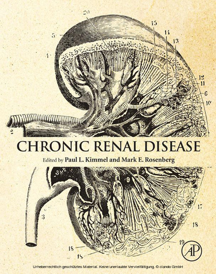 Chronic Renal Disease main product photo