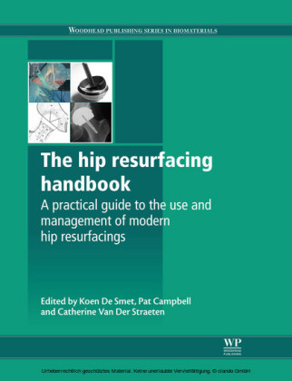 The Hip Resurfacing Handbook