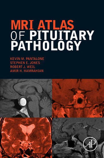MRI Atlas of Pituitary Pathology main product photo