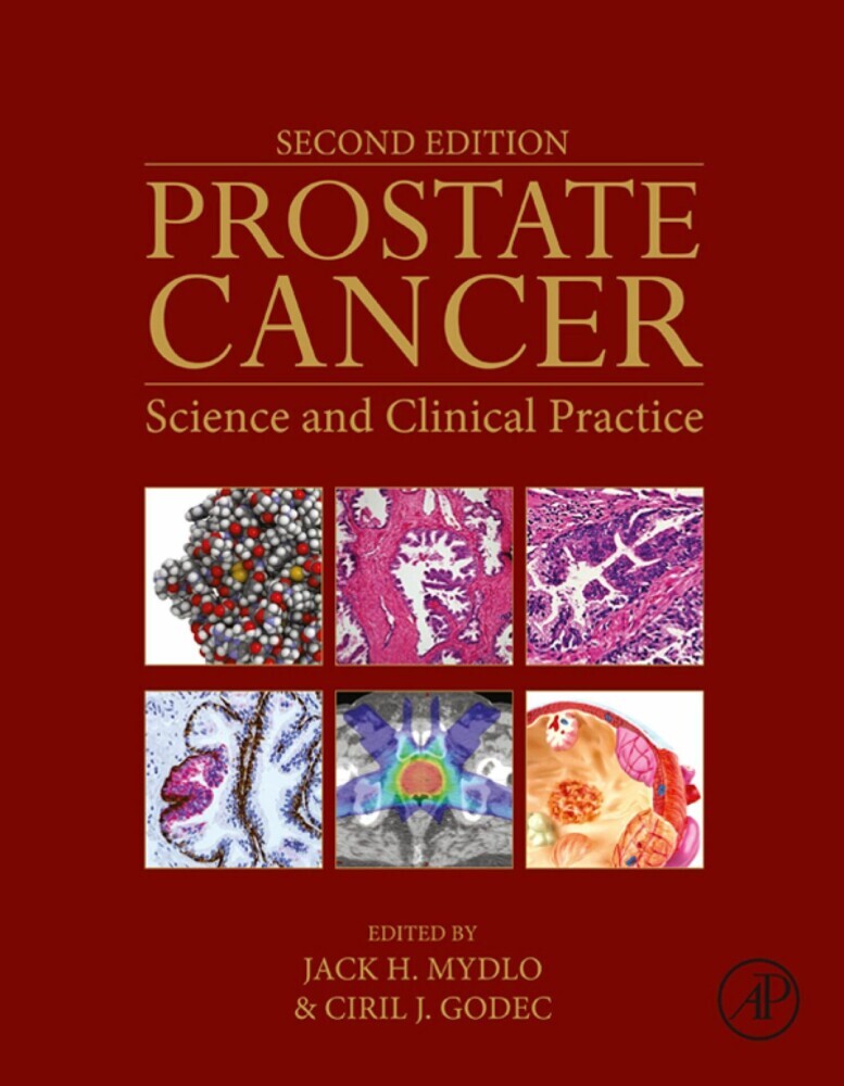 Prostate Cancer main product photo