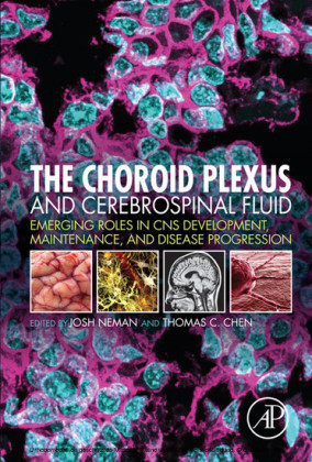 The Choroid Plexus and Cerebrospinal Fluid