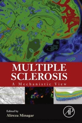 Multiple Sclerosis