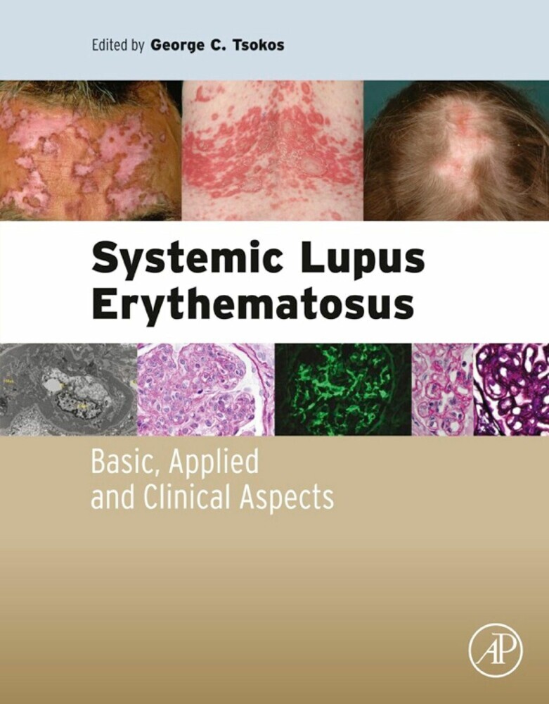 Systemic Lupus Erythematosus main product photo