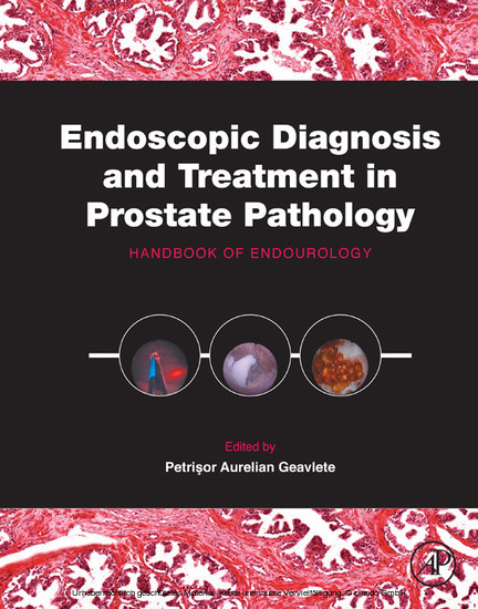 Endoscopic Diagnosis and Treatment in Prostate Pathology main product photo