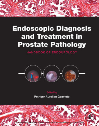 Endoscopic Diagnosis and Treatment in Prostate Pathology