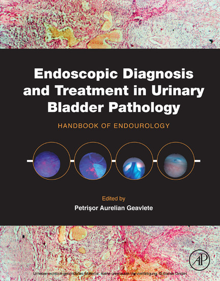 Endoscopic Diagnosis and Treatment in Urinary Bladder Pathology main product photo