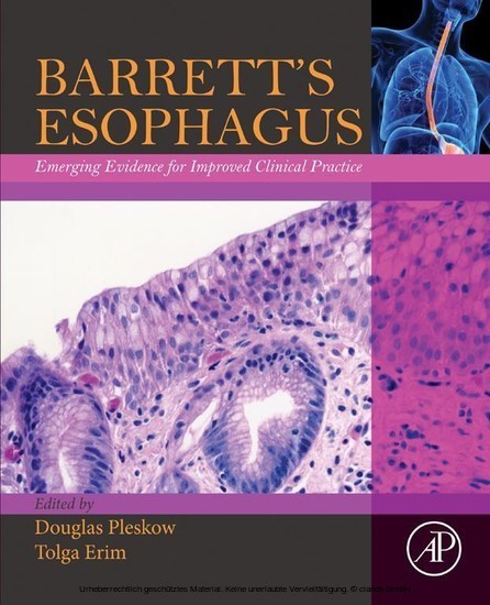 Barrett's Esophagus main product photo