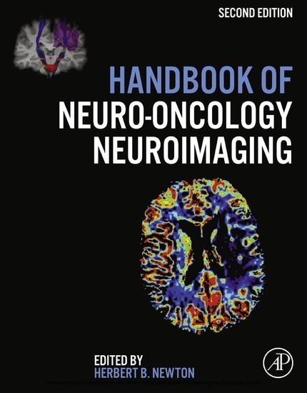 Handbook of Neuro-Oncology Neuroimaging main product photo