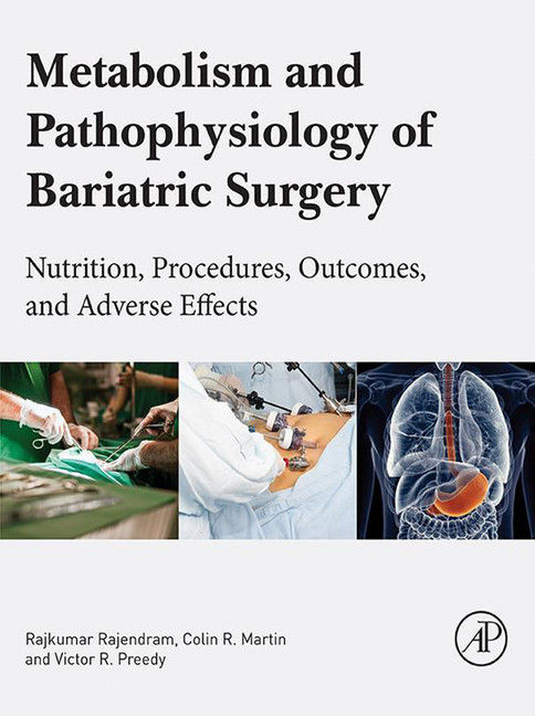 Metabolism and Pathophysiology of Bariatric Surgery main product photo