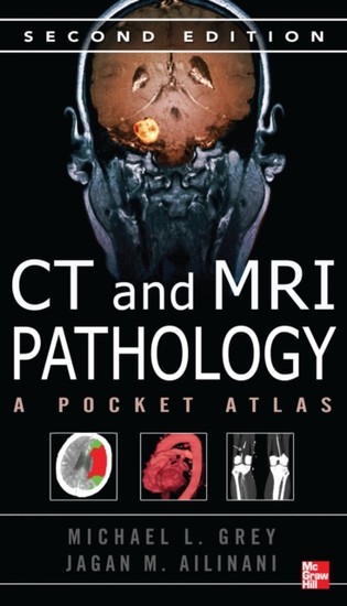 CT & MRI Pathology: A Pocket Atlas, Second Edition main product photo