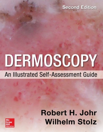 Dermoscopy: An Illustrated Self-Assessment Guide, 2/e main product photo