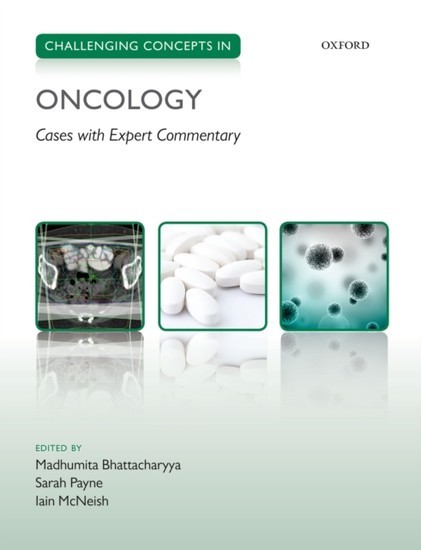 Challenging Concepts in Oncology main product photo