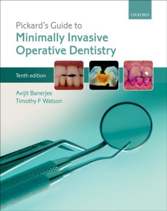 Pickards Guide to Minimally Invasive Operative Dentistry
