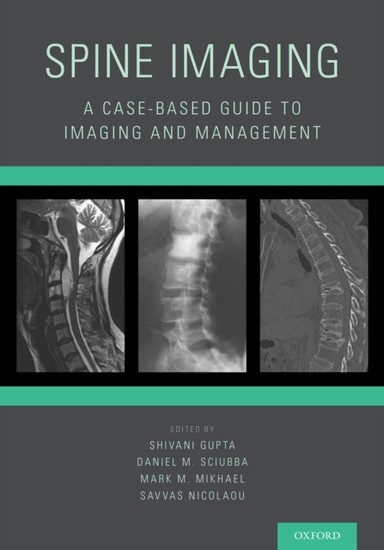 Spine Imaging: A Case-Based Guide to Imaging and Management main product photo