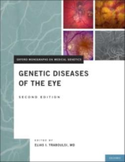 Genetic Diseases of the Eye main product photo