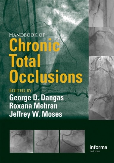Handbook of Chronic Total Occlusions main product photo
