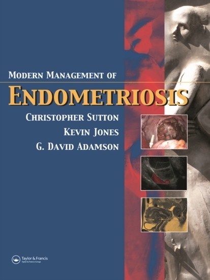 Modern Management of Endometriosis main product photo