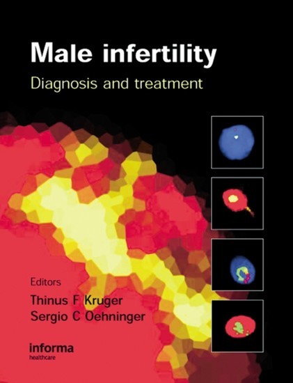Male Infertility main product photo