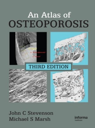 Atlas of Osteoporosis, Third Edition