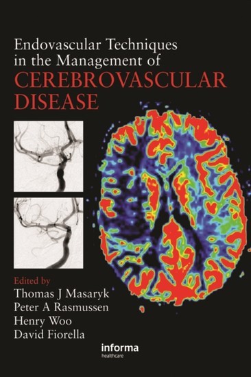 Endovascular Techniques in the Management of Cerebrovascular Disease main product photo
