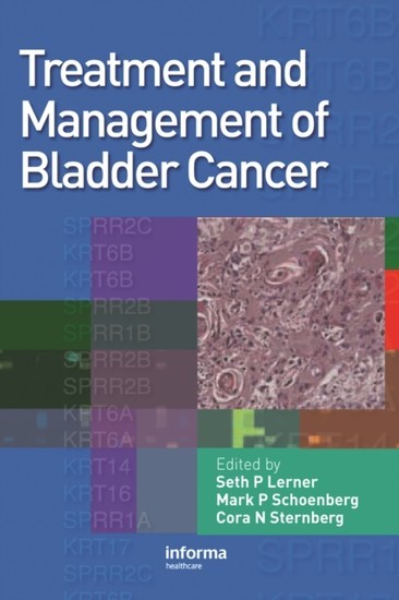 Treatment and Management of Bladder Cancer main product photo