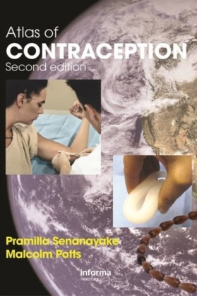 Atlas of Contraception, Second Edition