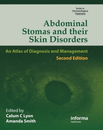 Abdominal Stomas and Their Skin Disorders,Second Edition