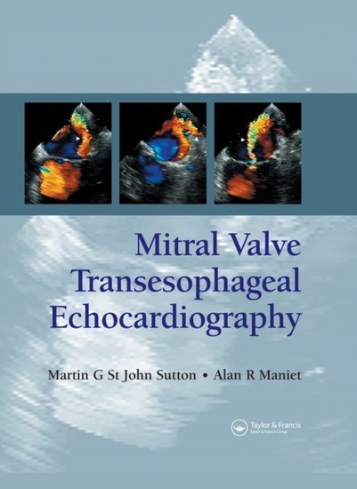 Mitral Valve Transesophageal Echocardiography main product photo