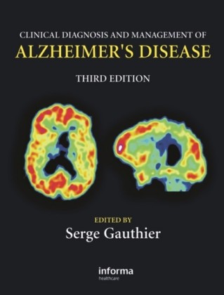 Clinical Diagnosis and Management of Alzheimer's Disease, Third Edition