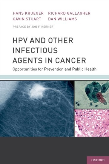 HPV and Other Infectious Agents in Cancer: Opportunities for Prevention and Public Health main product photo