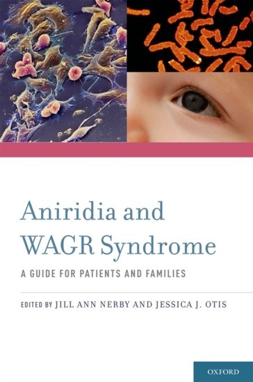 Aniridia and WAGR Syndrome: A Guide for Patients and Their Families main product photo