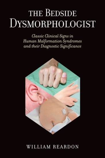 Bedside Dysmorphologist main product photo