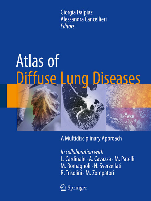 Atlas of Diffuse Lung Diseases main product photo