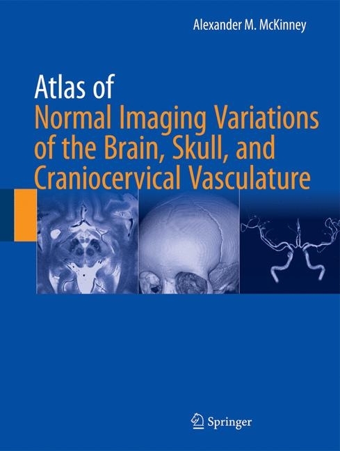 Atlas of Normal Imaging Variations of the Brain, Skull, and Craniocervical Vasculature main product photo