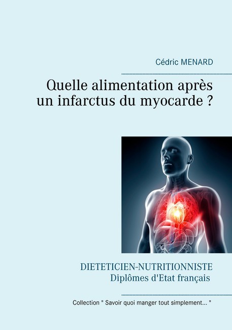 Quelle alimentation après un infarctus du myocarde ? main product photo