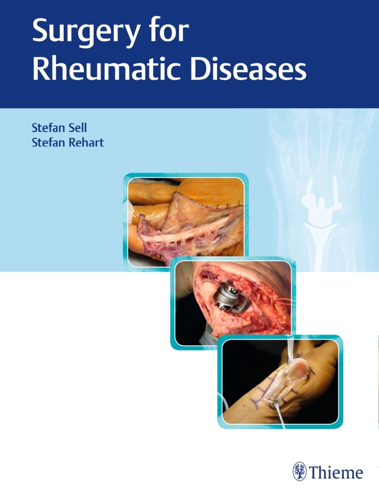 Surgery for Rheumatic Diseases main product photo