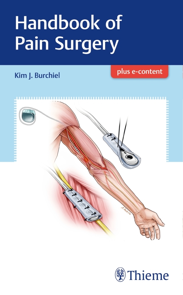 Handbook of Pain Surgery main product photo